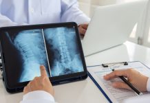 ONWARD unveil involvement in groundbreaking spinal cord injury trial spinal cord injury