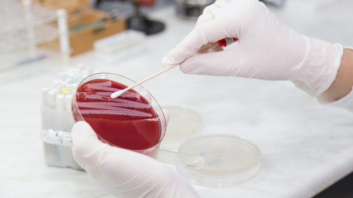 The Medical Microbiology Laboratory. Bacterial colonies phages