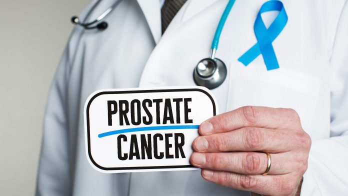 Doctor with stethoscope in white lab coat holding sign reading prostate cancer cause of prostate cancer