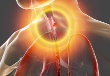 AI diagnostic tool may enhance detection of oesophageal cancer oesophageal cancer