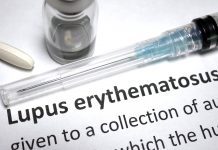 Saphnelo approved in the EU for treatment for systemic lupus erythematosus