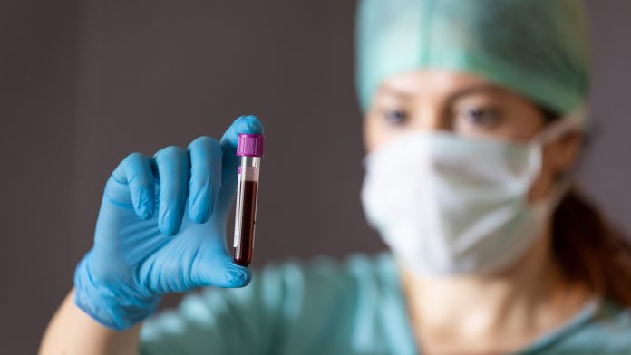 Creating universal blood type organs for transplants