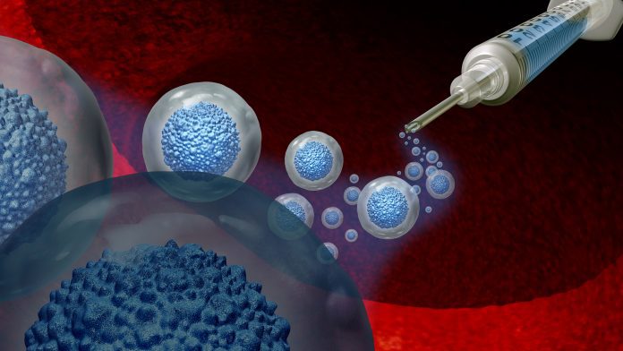Stem Cell Treatment stem cell transplant