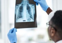 Lung damage persists long after COVID-19 pneumonia