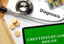 Creutzfeldt-Jakob disease