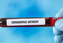 IgA antibodies may protect unvaccinated people from COVID-19 infection IgA antibodies