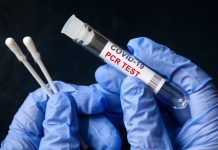 Innovative COVID-19 PCR test distinguishes all SARS-CoV-2 variants COVID-19 PCR test