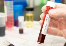 Cholera pandemic averted by two DNA defence systems Cholera Pandemic