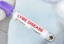Diagnosing Lyme Disease made easier with novel test Lyme Disease