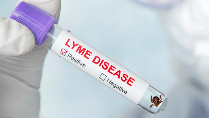 Diagnosing Lyme Disease Lyme Disease