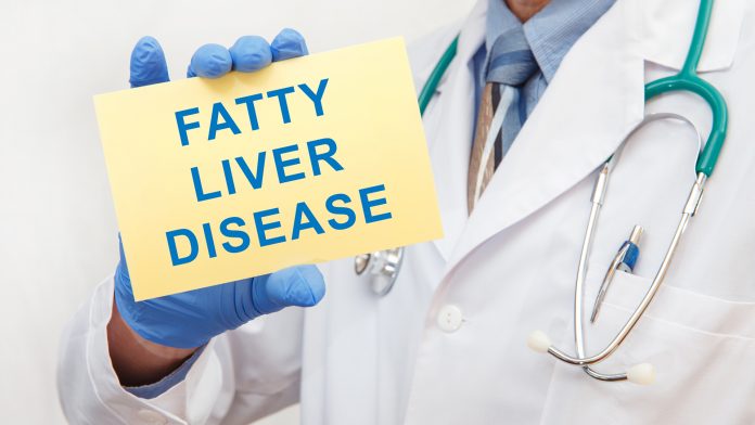 Doctor holding sign with text FATTY LIVER DISEASE closeup non-alcoholic fatty liver disease