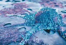 Scientists investigate metastatic prostate cancer Prostate Cancer