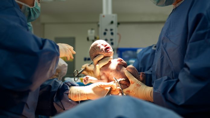 Emergency Caesareans