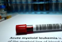 acute myeloid leukaemia
