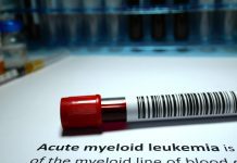 Scientists discover new acute myeloid leukaemia treatment targets acute myeloid leukaemia