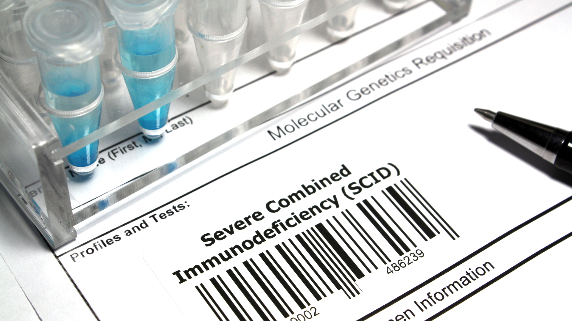 Promising therapy for recombination-deficient severe combined immunodeficiency