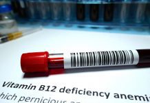 B12 deficiency in infants harms motor development