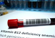 B12 deficiency in infants harms motor development B12 deficiency in infants harms motor development