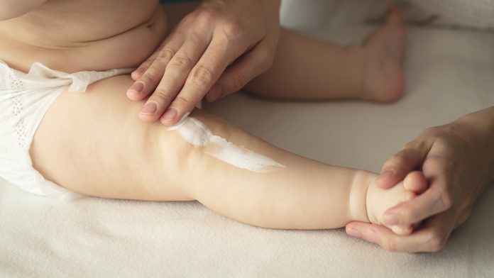 What is the best moisturiser for eczema in children?