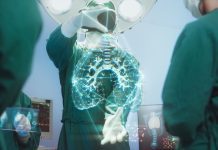 Innovative AI technology identifies COVID-19 lung damage COVID-19 lung damage