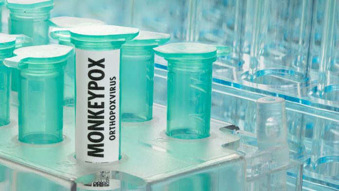 © iStock-Bill Oxford monkeypox symptoms