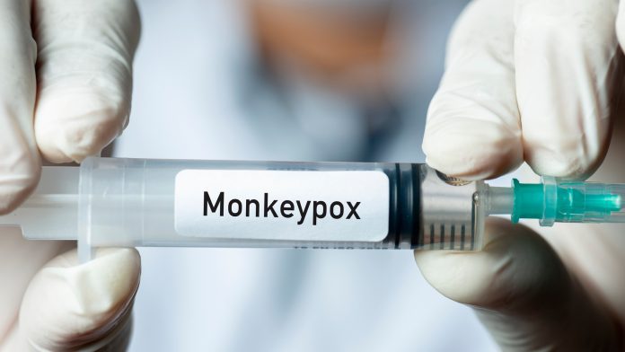 monkeypox virus