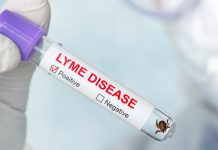 14% of the global population may have tick-borne Lyme disease tick-borne Lyme disease
