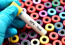 Five-year HPV testing intervals show excellent safety HPV testing