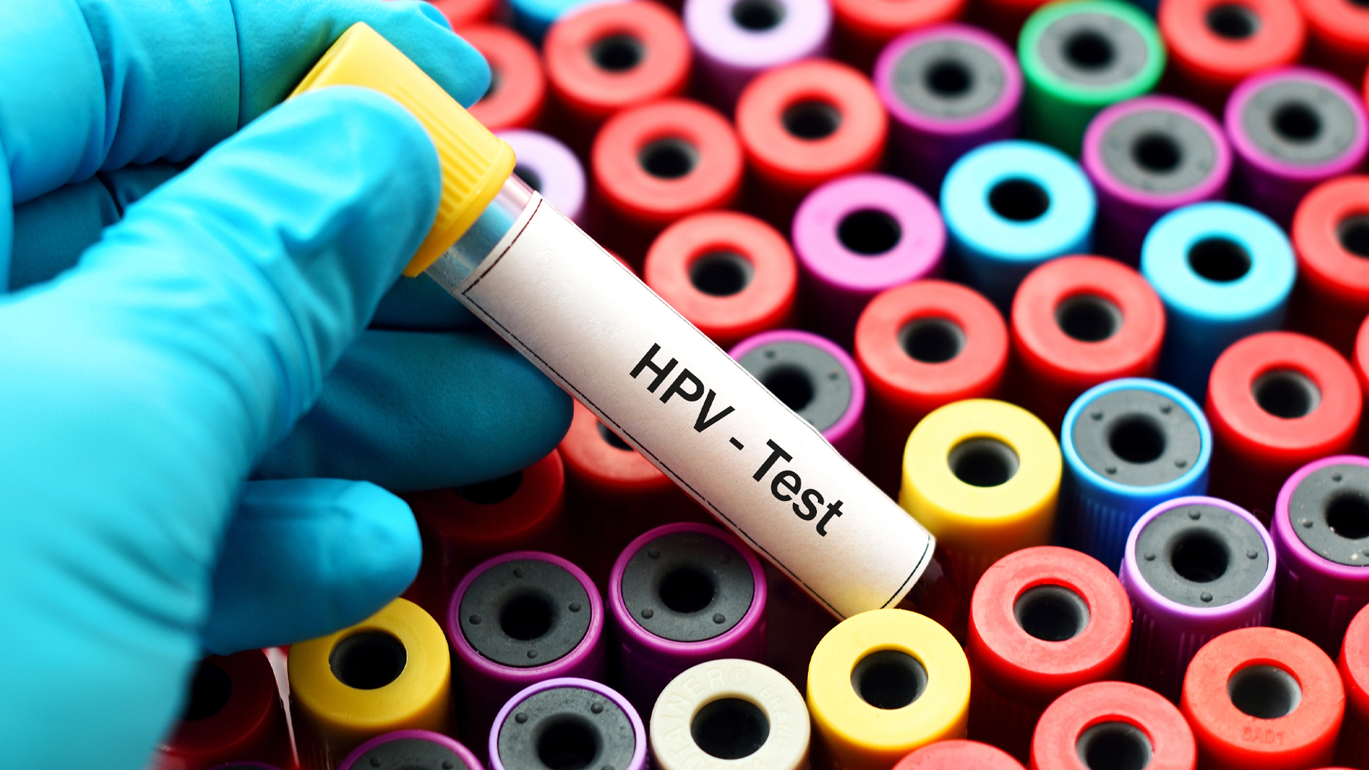 HPV testing