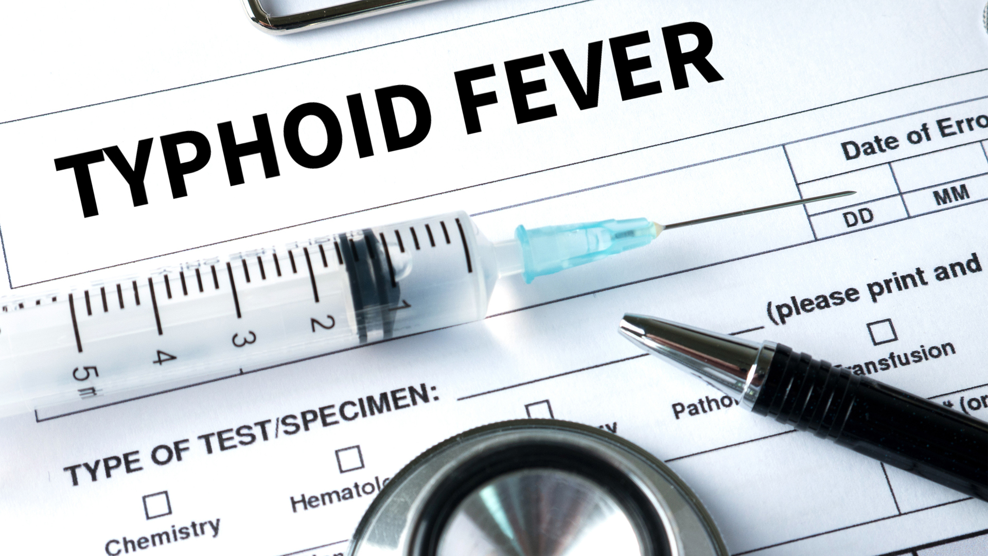 typhoid fever