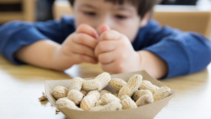 Food allergies in children can be reduced by early food introduction