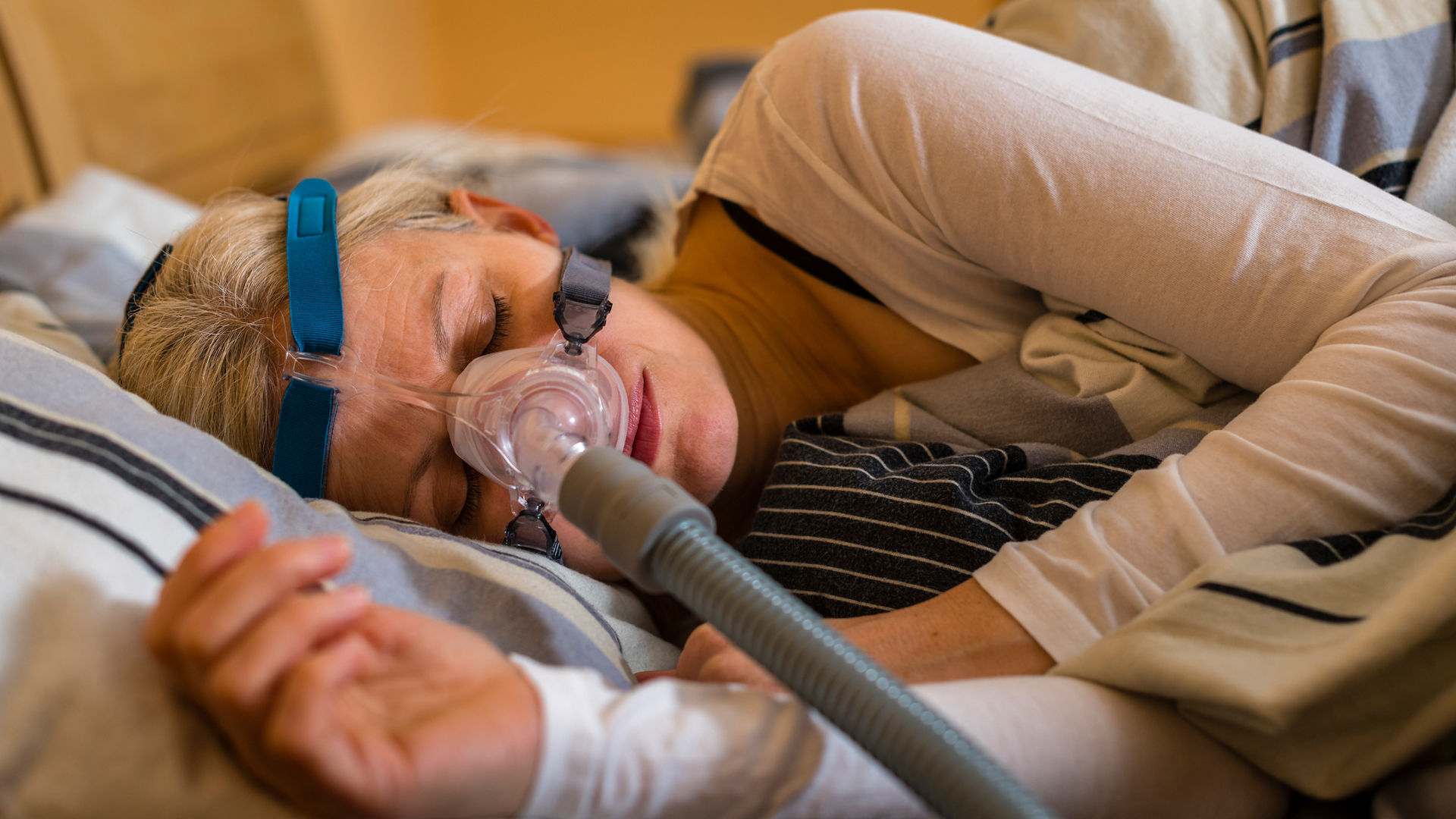 obstructive sleep apnoea