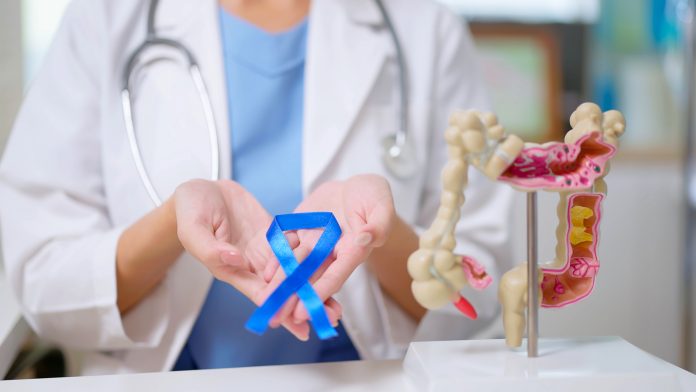 Colon Cancer concept symptoms of bowel cancer
