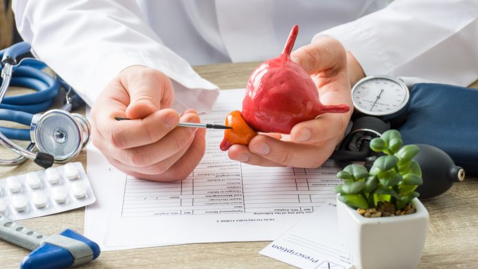 At doctors appointment physician shows to patient shape of prostate gland with focus on hand with organ. Scene explaining patient causes and localization of diseases of prostate, problems and signs prostate biopsies