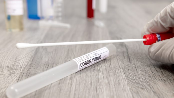 Cotton swab with tube labelled as Coronavirus skin swab test