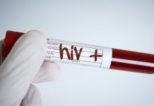 treatments for HIV