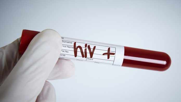 treatments for HIV
