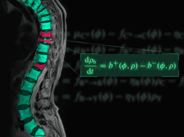 The equation symbolising the mathematical model of osteoporosis overlaid on an image showing osteoporotic fractures (red) in the thoracic spine.