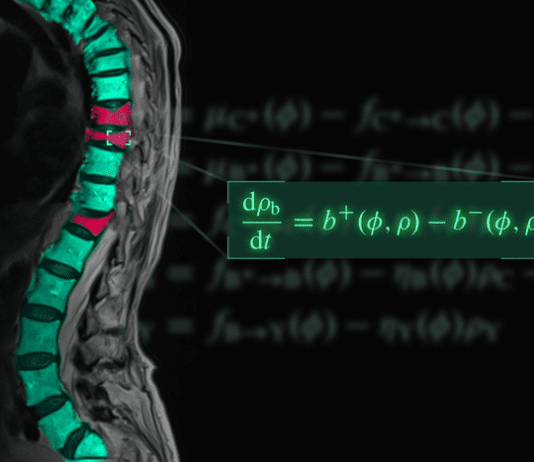 The equation symbolising the mathematical model of osteoporosis overlaid on an image showing osteoporotic fractures (red) in the thoracic spine.