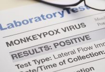 Monkeypox variants assigned new names by WHO