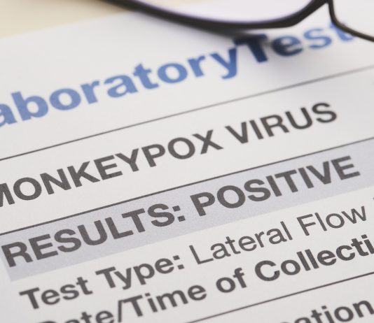 Monkeypox variants assigned new names by WHO