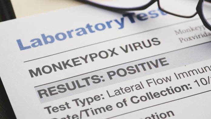 Monkeypox variants assigned new names by WHO