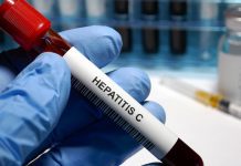 New NHS programme aims to provide Hepatitis C treatment
