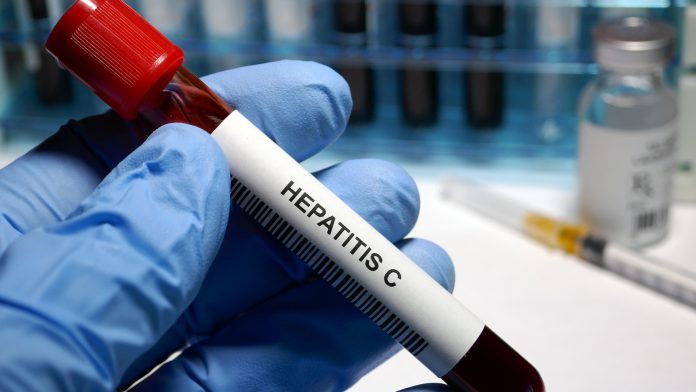 New NHS programme aims to provide Hepatitis C treatment