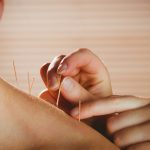 Could acupuncture help people with prediabetes?