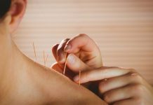 Could acupuncture help people with prediabetes?