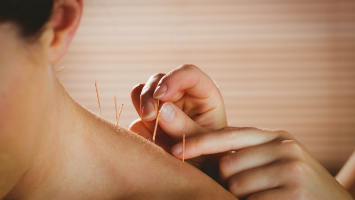 Could acupuncture help people with prediabetes?