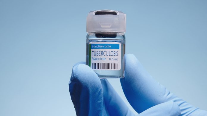 tuberculosis vaccine