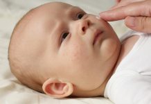 Biomarker test predicts the development of eczema in babies 