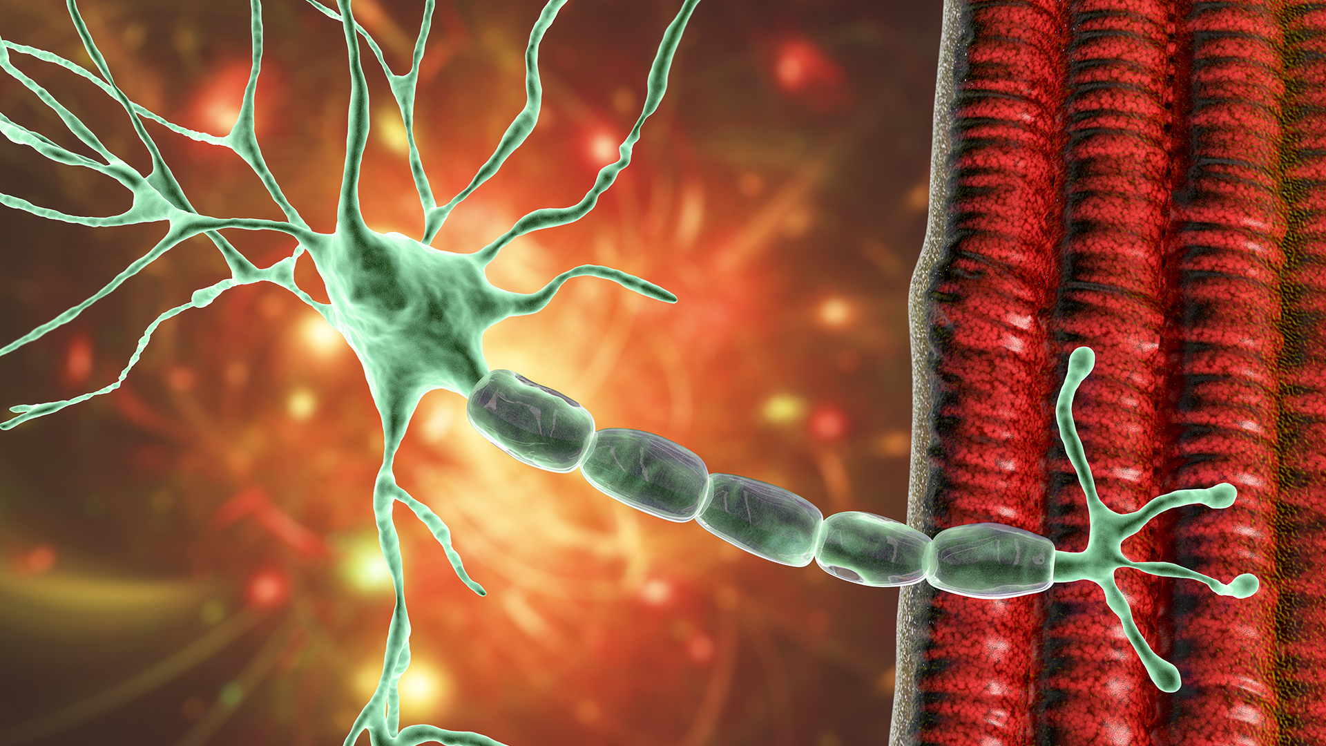 An arthritis drug may provide an affordable treatment for myasthenia